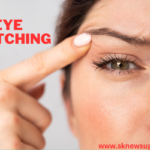 Eye Twitching is not a bad omen, it is a sign of disease, there may be deficiency of these things in the body.